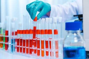 Wall Mural - Asian people scientist in lab coat and protective gloves working with test tubes with green and red liquids, with microscope and other test tubes in the background in laboratory.