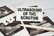 On the ultrasound pictures there is a pen and a business card with the inscription - Ultrasound of the scrotum