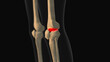 Medical animation of the knee pain