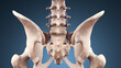 Posterior Lumbar Fusion with Pedicle Screws and Rods