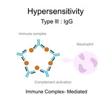 Fototapeta  - The diagram of Hypersensitivity type lll : Immune complex -Mediated that shows the Immune complex of Antigens and Antibodies indued complement activation , neutrophil and Inflammation Process.