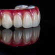 zircon bridge on 8 dental implants