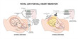 Fetal (or foetal) heart monitor medical equipment illustration