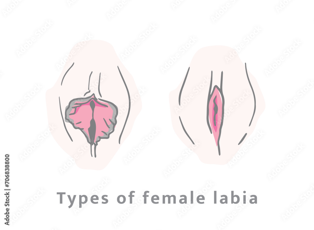 different types of female vulvae. Women's vaginas of different colors