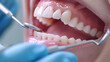 At the dentist, a patient with a beautiful smile,
straight and beautiful teeth, for examination, modern dentistry.