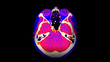 CT Brain Perfusion or CT scan image of the brain axial view .