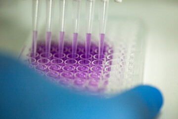 cell culture at the safety cabinet in cell culture laboratory, cancer and medicine research 