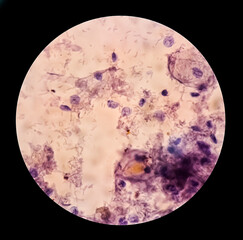 Canvas Print - Trichomonas vaginalis is an anaerobic, flagellated protozoan parasite and the causative agent of trichomoniasis.