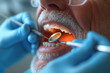 Close-up of an elderly man's face with his mouth open, sitting in a dental chair while having his teeth examined and treated by a qualified dentist. Dentist day