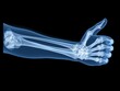 © Muriel - Success symbol, x-ray image of a forearm and hand with thumb up and folded fingers, ok radiography photograph, illustration of achievement, positive results or answer, problem solved, approval sign