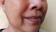 © Rung Kh - close up portrait of the wrinkle and Flabby skin beside the mouth, dullness and dark spots on the face of the woman, health care and beauty concept.