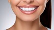© Irina - Beautiful female smile after teeth whitening procedure. Dental care. Dentistry concept.