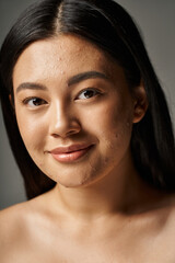 Wall Mural - pleased young asian woman with skin issues and bare shoulders looking at camera on grey background