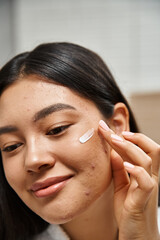 Wall Mural - close up photo of young asian woman with brunette hair applying acne treatment cream on face