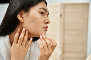 Wall Mural - young asian woman with brunette hair examining her skin with acne in the mirror, skin issue