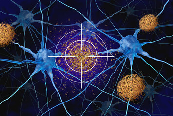 Targeting Amyloid Plaque as a trgeted Therapy for plaques made of abnormal clusters of protein fragments that accumulate between nerve cells destroyed or dissolved as a tretment to halt or slow down A