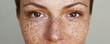 Freckles.Pigmentation. Cropped half face portrait of a young woman grey background. Natural beauty and glowing clean hydrated freckled skin.