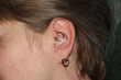 Ear cartilage piercing on a woman. Macro. Daith piercing + ball captive ring with cubic zirconia.	