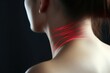 A woman with distinct red lines on her neck. Can be used to illustrate medical conditions or injuries