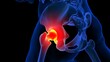 © mybox - Hip joint pain anatomy for medical concept 3D rendering