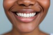 © Tymofii Borysenko - Close up shot of a black woman smiling with perfect white teeth