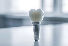 Close Up Of Dental Teeth Implant Isolated On Light Grey Background