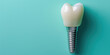 3D Render of a Dental Implant in Jaw, blue background with copy space. Detailed illustration of a dental implant in the gum line among natural teeth.