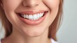 © Sasint - Cropped shot of a young Caucasian smiling woman. Teeth whitening. Dentistry, dental treatment.