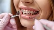 A woman with metal braces on her teeth undergoing orthodontic treatment.