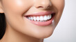 © Nitcharee - Woman smiling with healthy white teeth , an Oral day , Dentist day,Mouth and oral care