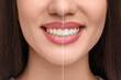 © New Africa - Woman showing teeth before and after whitening, collage