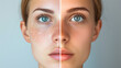 Face before and after skin treatment.