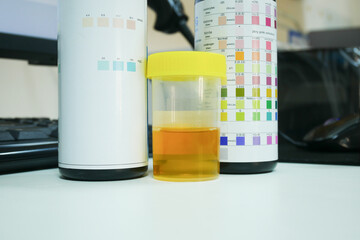 Wall Mural - Urine analysis in laboratory.