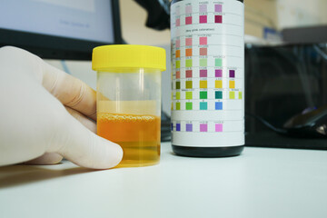 Wall Mural - Urine analysis in laboratory.