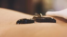 Close-up Shot Of Medical Leech On Human Body Skin Drinking Blood, Traditional Medicine, Hirudotherapy. Treatment With Leeches And Bloodletting. Freshwater Worm. Alternative Treatment Health Concept 4k