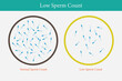 © abdul - normal and low sperm count illustration. Male infertility oligospermia. Structure of the sperm. Vector. eps 10