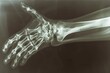 This photo is an x-ray image of a hand that clearly shows a long bone within the hands structure, A dislocation seen through an x-ray lens, AI Generated