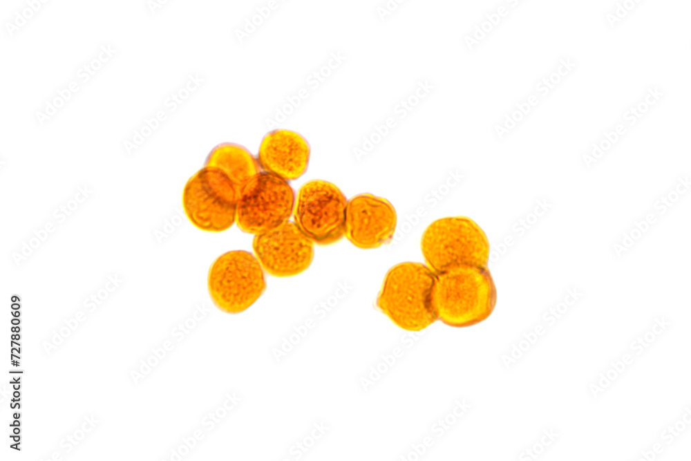 Pollen und the light microscope, whole mount, 80X light micrograph. Magnified ungerminated apple pollen grains, a fine, coarse powdery substance, in this stadium called microspore or mother cell.