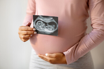 Wall Mural - Unrecognizable black pregnant lady demonstrating her baby sonography photo