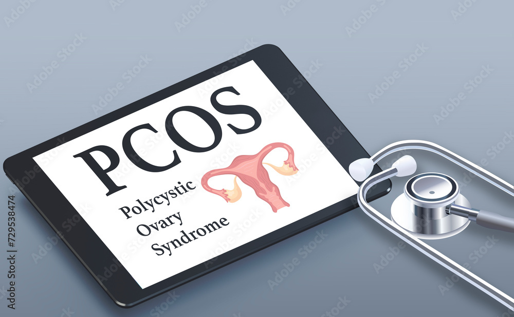 Pcos Scan Background PCOS, polycystic ovary syndrome, uterus text and icon on tablet with ...