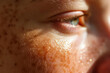 A person with damaged skin from too much sun exposure causing sun burn