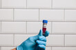 Close-up of doctor's hand wearing medical gloves holding a blood probe in front of a laboratory wall