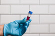 Close-up of doctor's hand wearing medical gloves holding a blood probe in front of a laboratory wall