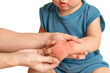Asian baby have red swollen and blister on hand caused by insect bite, on white background.