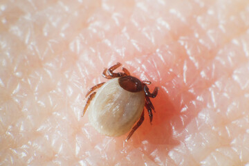 Mite are sucking blood from a human skin