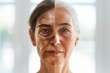 Aging stress management for senior. Young to old volunteerism for senior. Wrinkle Reducation, facial hives, social security, skin care, anti aging cream, parenthood planning, facial contouring