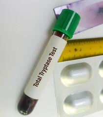 Poster - Blood sample for Total Tryptase test. A tryptase test can help doctors determine if a severe allergic reaction (ANAPHYLAXIS) has occurred.