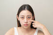 © Pormezz - Bored, insomnia asian young woman, girl looking at mirror hand touching under eyes with problem of black circles or panda puffy, swollen and wrinkle on face. Sleepless, sleepy healthcare person.