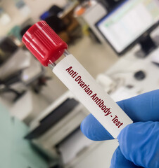 Poster - Blood sample for Anti Ovarian Antibody test to diagnose Female Infertility as well as during and after the infertility treatment.