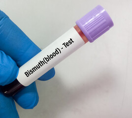 Wall Mural - Blood sample for Bismuth (heavy metal) test, toxic metal. Diagnosis of Bismuth toxicity.